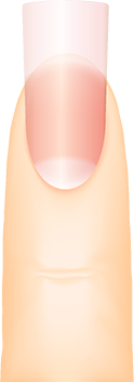 Flare nail